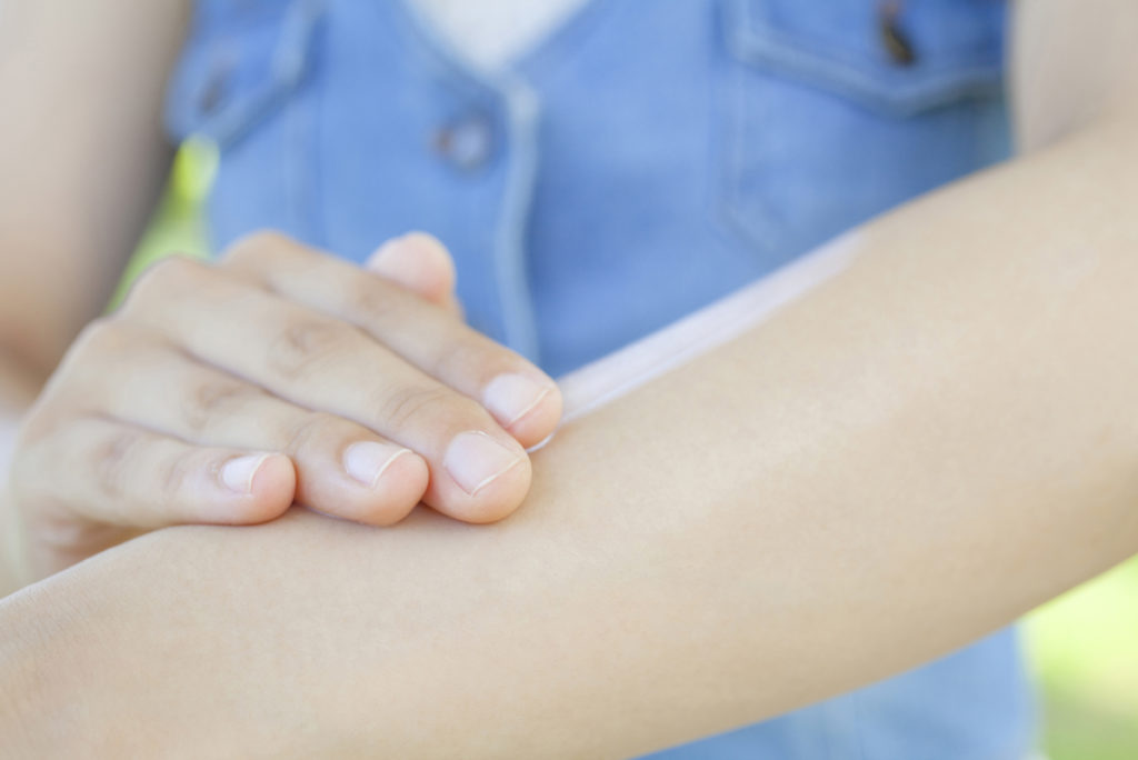 脱毛中の日焼け、どのレベルなら大丈夫？また、どのくらいの期間で再開できる？日焼け肌でも脱毛可能な施術方法もご紹介！